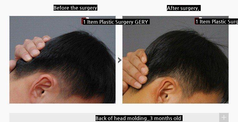 SOUND Plastic surgery that men do a lot.jpg