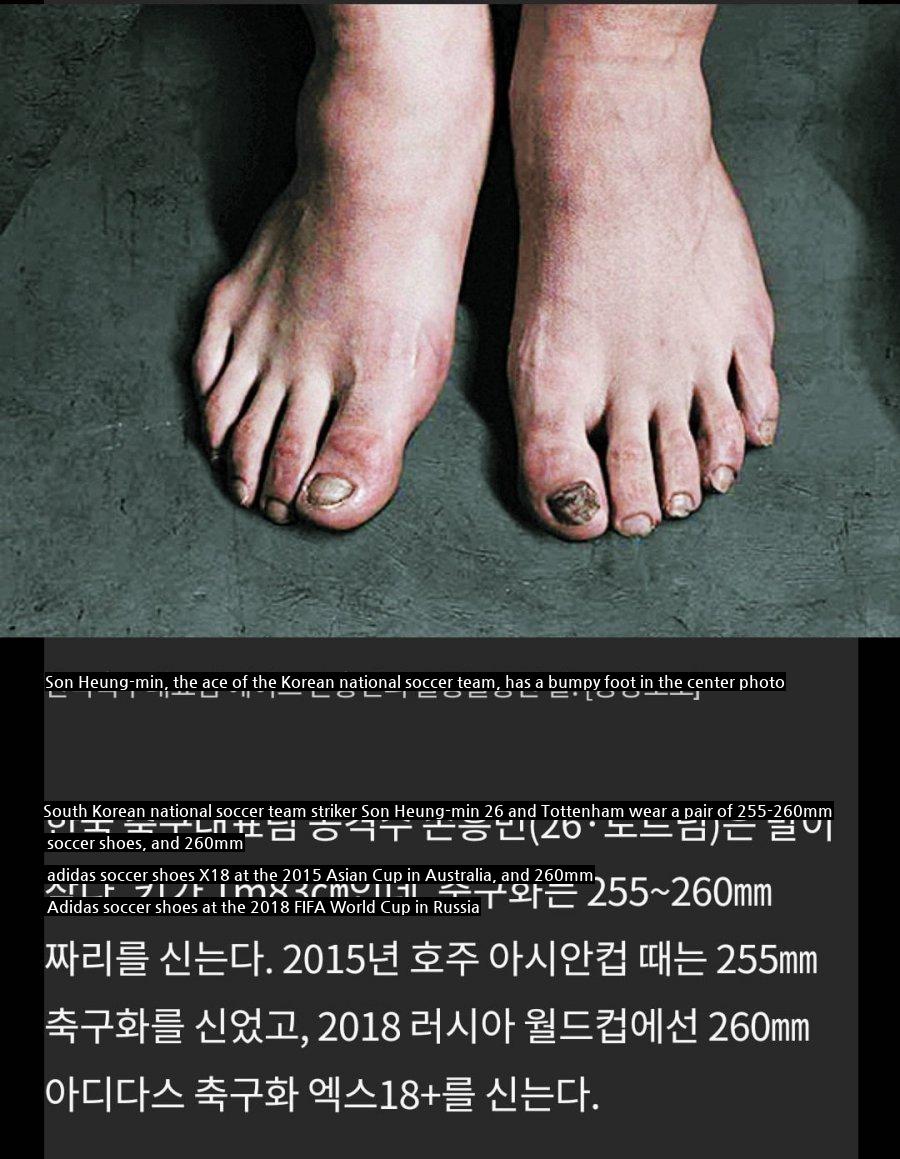 Surprisingly, Son Heung-min's foot size.jpg