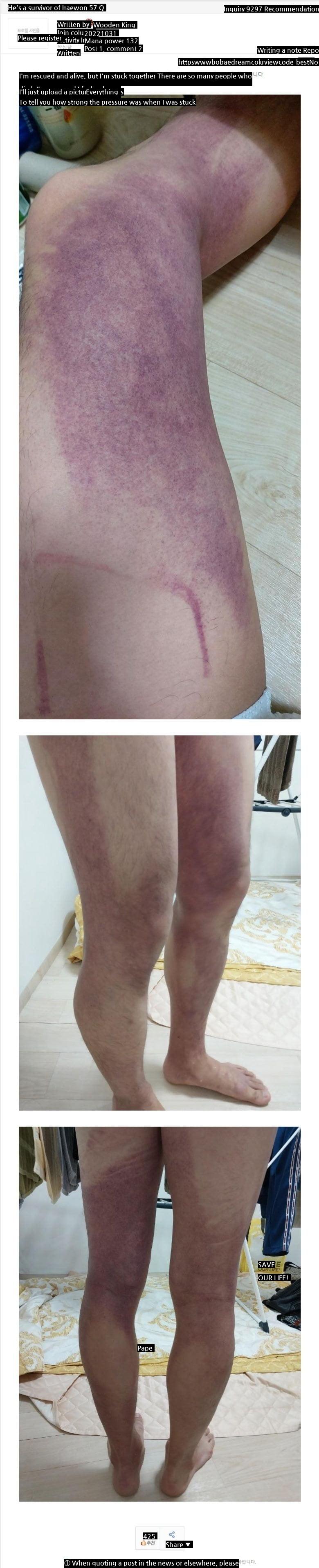 The state of his legs posted by a survivor of the Itaewon disaster.jpg
