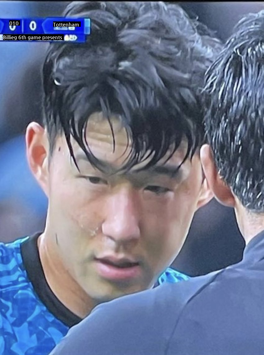 Click caution Son Heung-min's face condition jpg