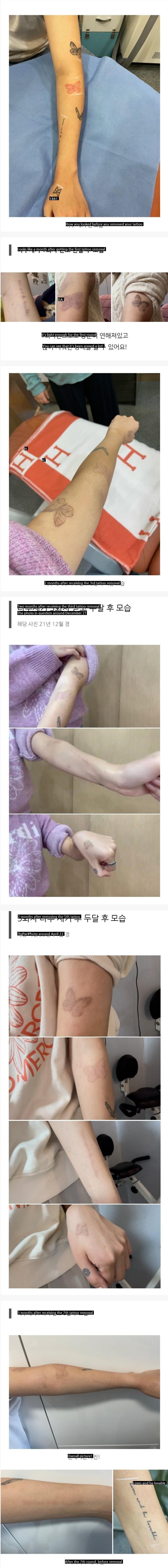 a wife and child who recorded the tattoo removal process