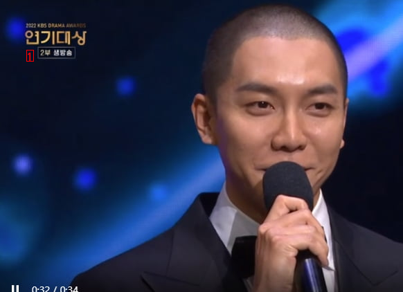 Lee Seung Gi's hair transplant is really good