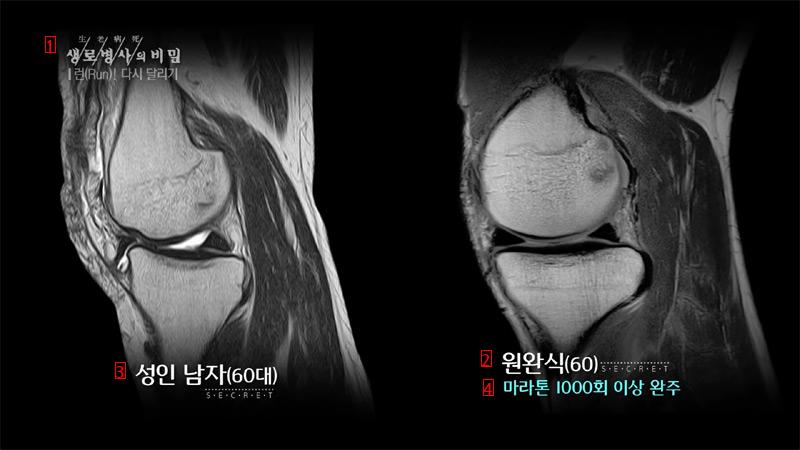 The truth about running hurts your knees