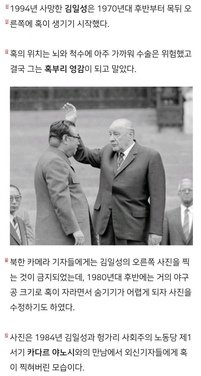 Kim Il-sung's hump caught by foreign media in 1984