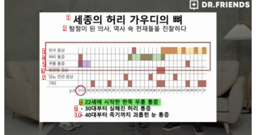 The truth of King Sejong's obesity story that an orthopedic surgeon sees''ㄷㄷ