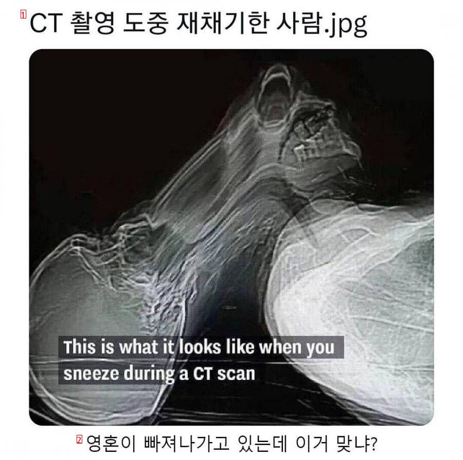 Anyone sneezed during CT scan jpg