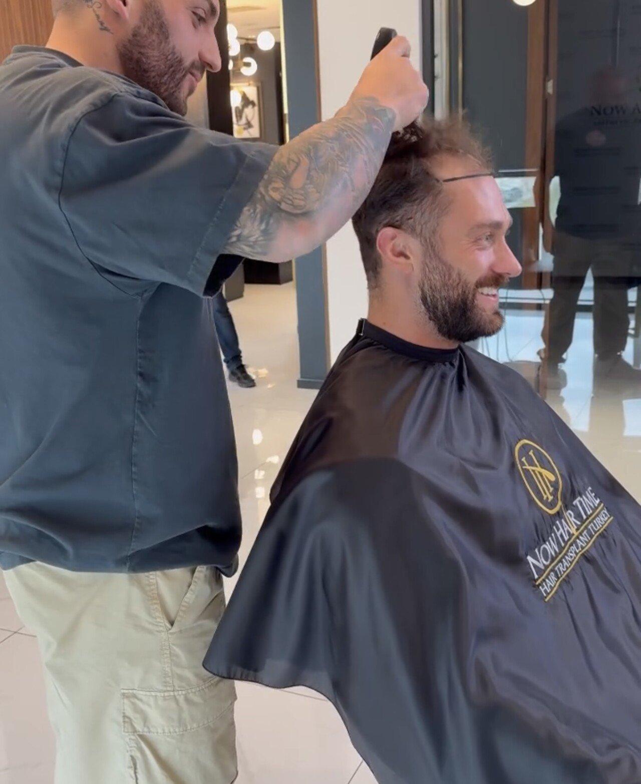 Chris Bumstead C.B.I. Hair Transplant in Turkey