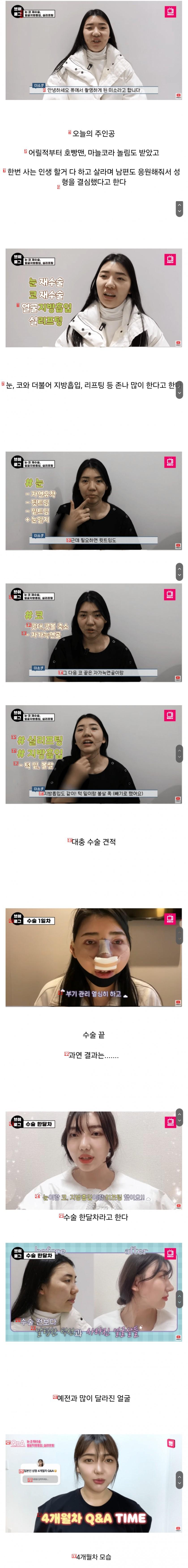 Sushi Girl Who Got Plastic Surgery in Korea