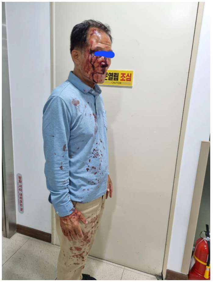 Alleged) Taxi driver suffered a broken nose after assaulting a passenger in Pohang