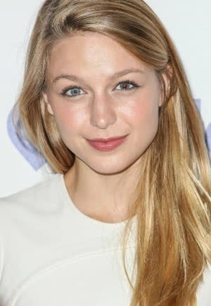 Actress Melissa Benoist became an acquired odd-eye