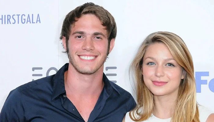 Actress Melissa Benoist became an acquired odd-eye