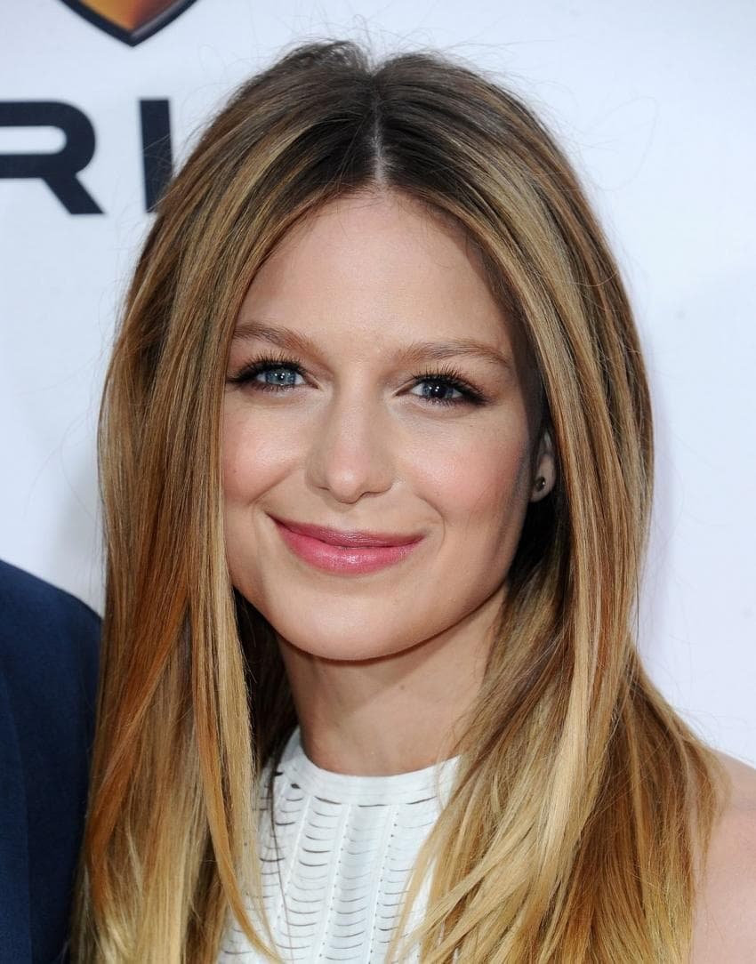 Actress Melissa Benoist became an acquired odd-eye