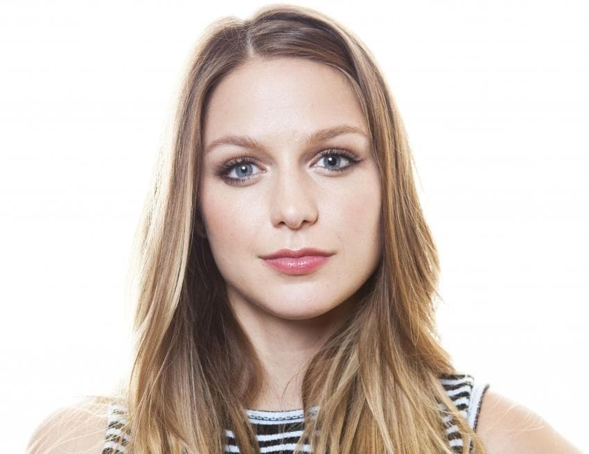 Actress Melissa Benoist became an acquired odd-eye