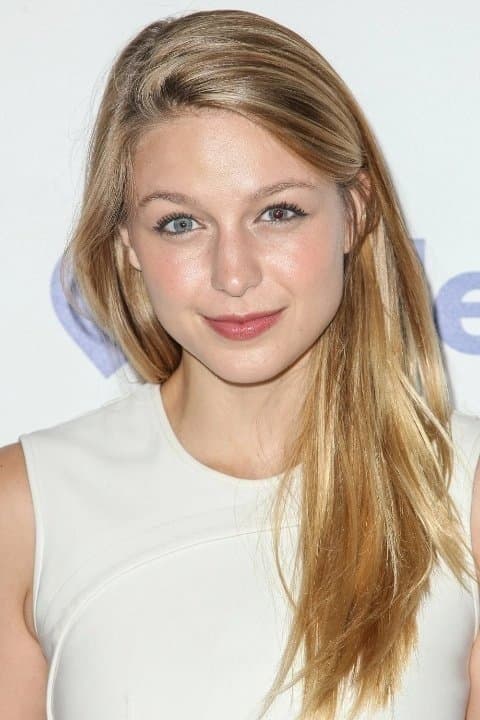 Actress Melissa Benoist became an acquired odd-eye